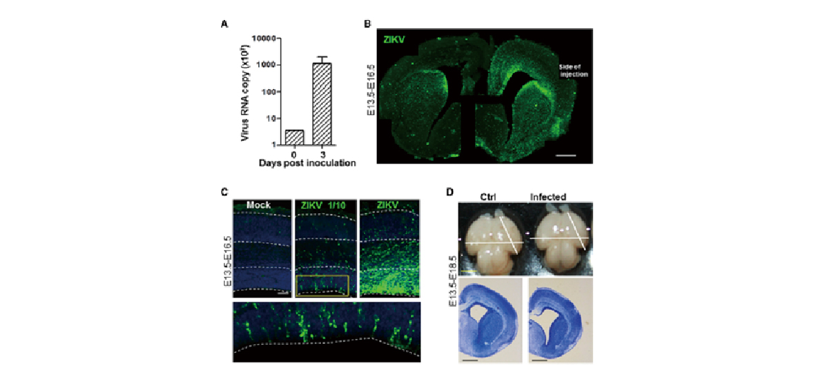 图1 ZIKV在小鼠胚胎脑组织高效的复制引起小头畸形